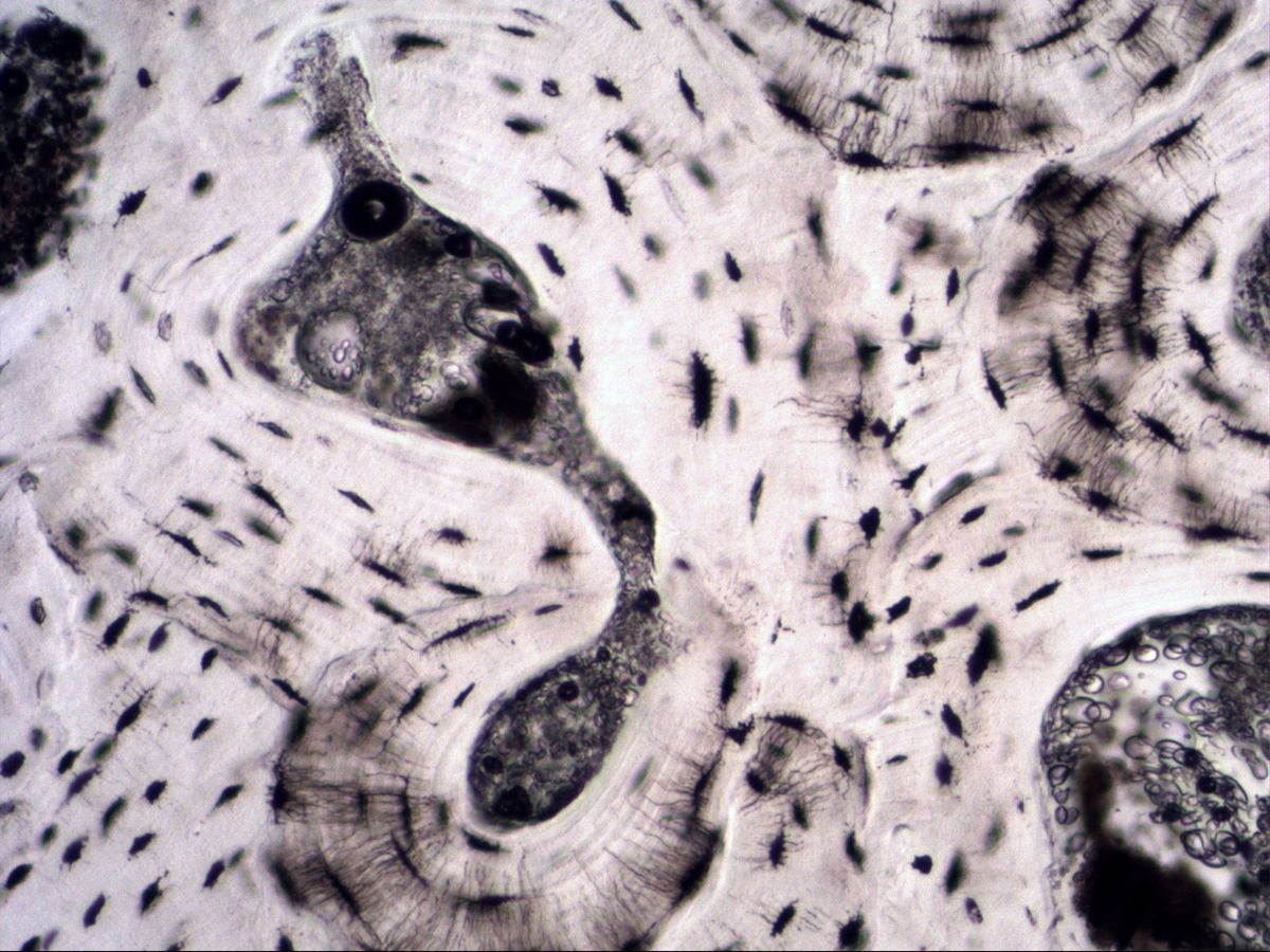 Osteocyte lacunae with canaliculi in bone ground section, high magnification