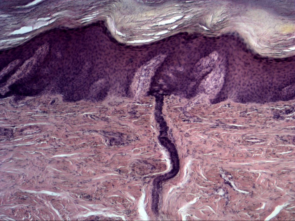 Skin, H&E, epidermis, sweat duct and interwoven connective tissue of the dermis