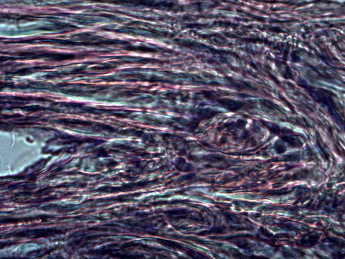 Dense irregular connective tissue of the dermis, high magnification, wavy collagen bundles