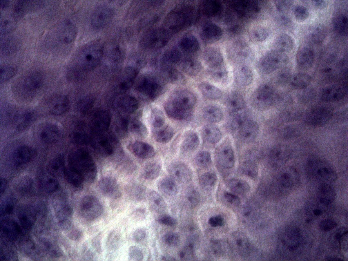 Keratinocytes of the stratum spinosum of skin, H&E, high magnification