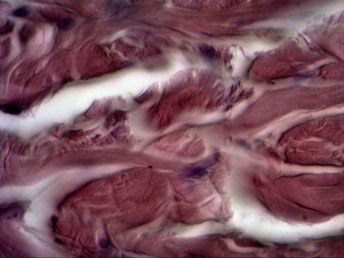 Collagen bundles and fibrocyte in the dermis, H&E, high magnification