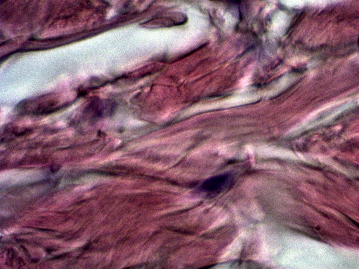 Fibrocyte between collagen bundles, dense connective tissue of skin, H&E, high magnification