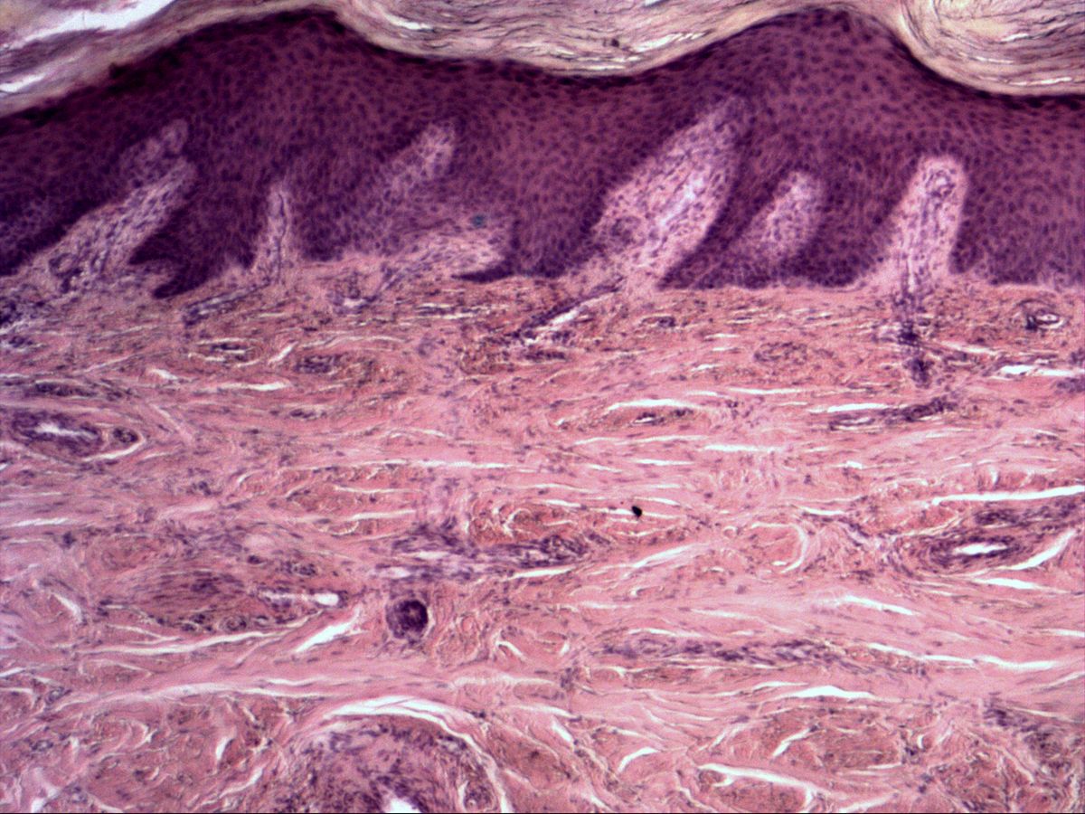 Skin, H&E, overview with epidermis, loose papillary dermis and dense irregular reticular dermis