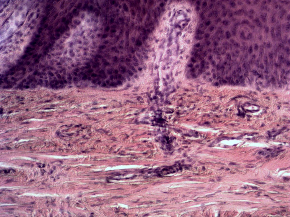 Dermal papilla and dermis, H&E, loose and dense irregular connective tissue, medium magnification