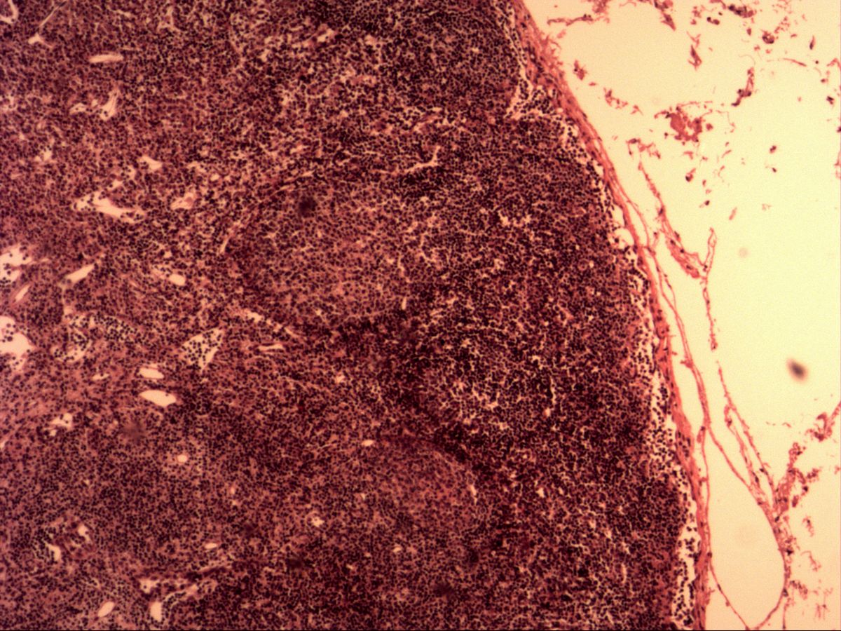 Lymphoid tissue with connective tissue capsule, probably lymph node, H&E, medium magnification