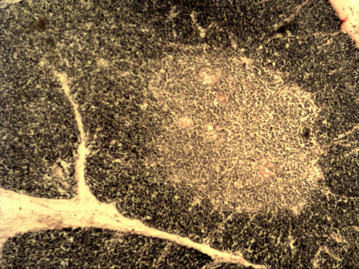 Thymus, H&E: pale medulla with Hassall's corpuscles, dark cortex and connective tissue septum
