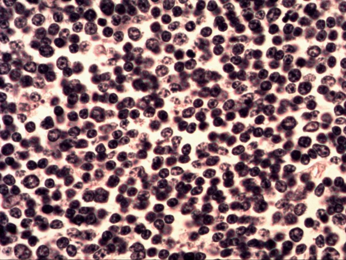 Densely packed lymphocytes in lymphoid tissue, H&E, high magnification