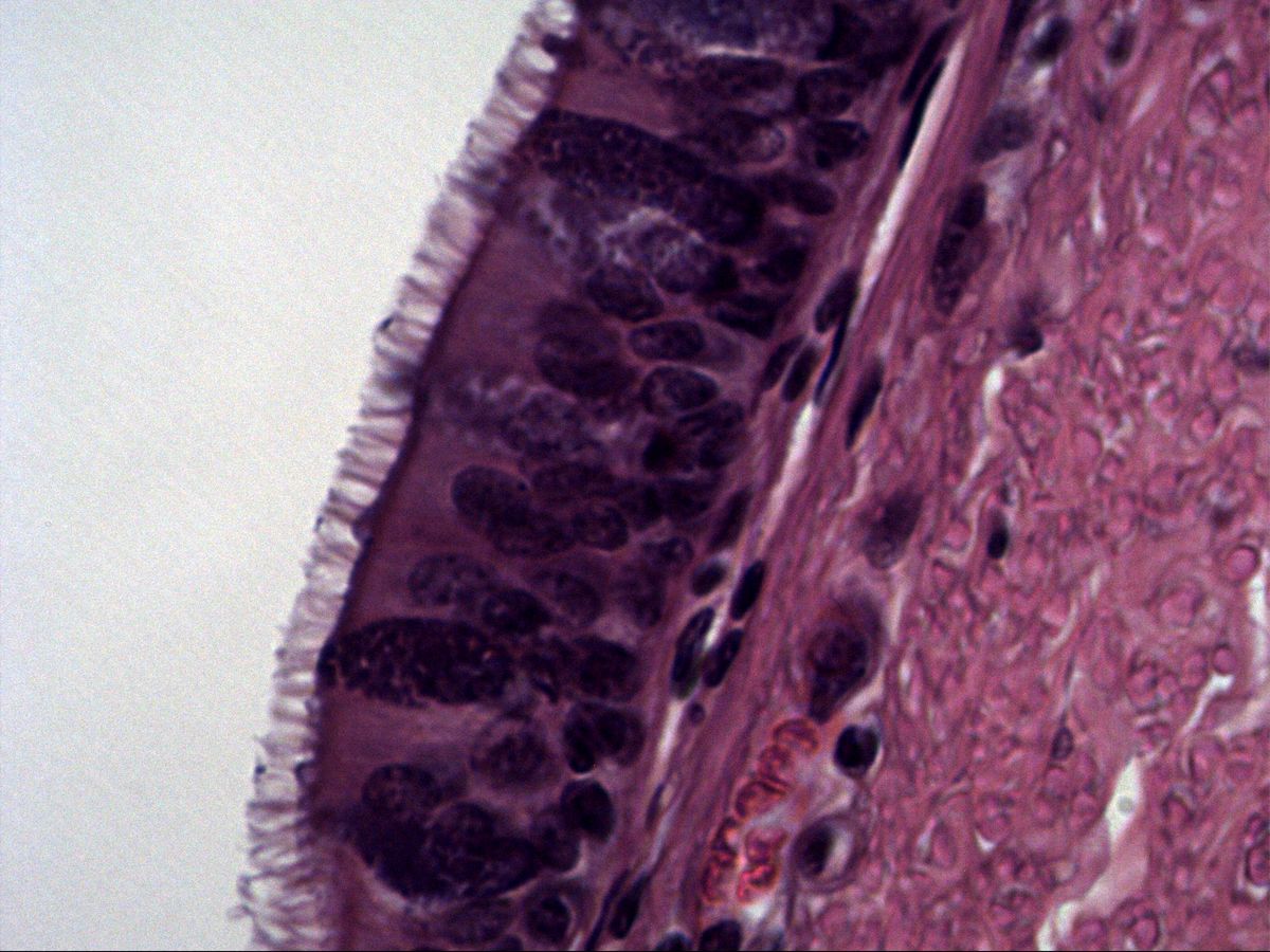 Trachea, H&E, high magnification: pseudostratified ciliated epithelium with cilia and basement membrane