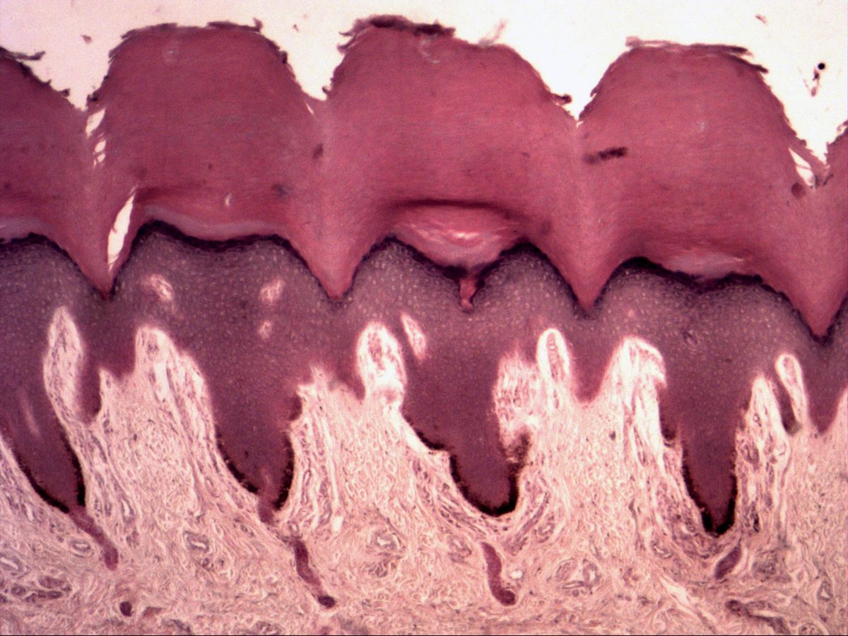 Fingertip skin, H&E, overview: epidermis with thick horny layer and dermis