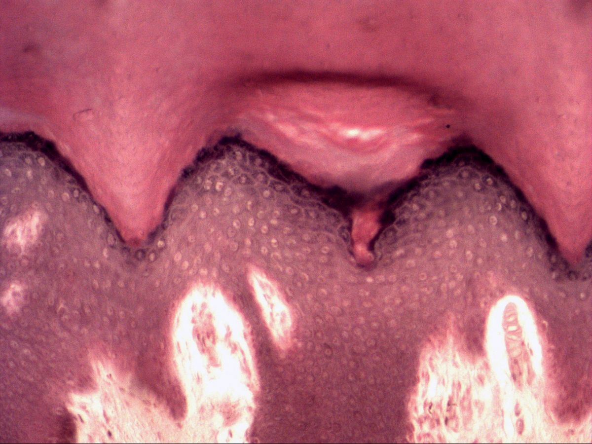 Fingertip skin, H&E, medium magnification: layers of the epidermis