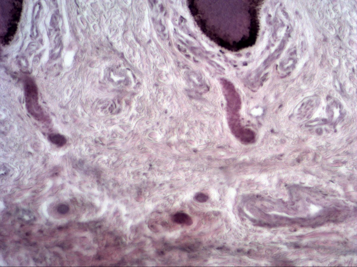 Fingertip skin, H&E, medium magnification: dermis with connective tissue below epidermal ridges