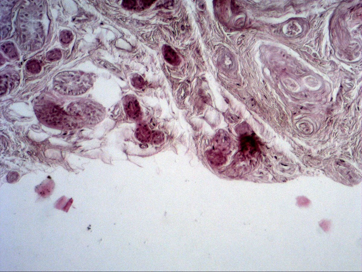 Fingertip skin, H&E, medium magnification: deep dermis with sweat gland profiles