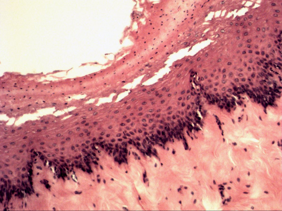Oesophagus, H&E, medium magnification: non-keratinised stratified squamous epithelium with papilla