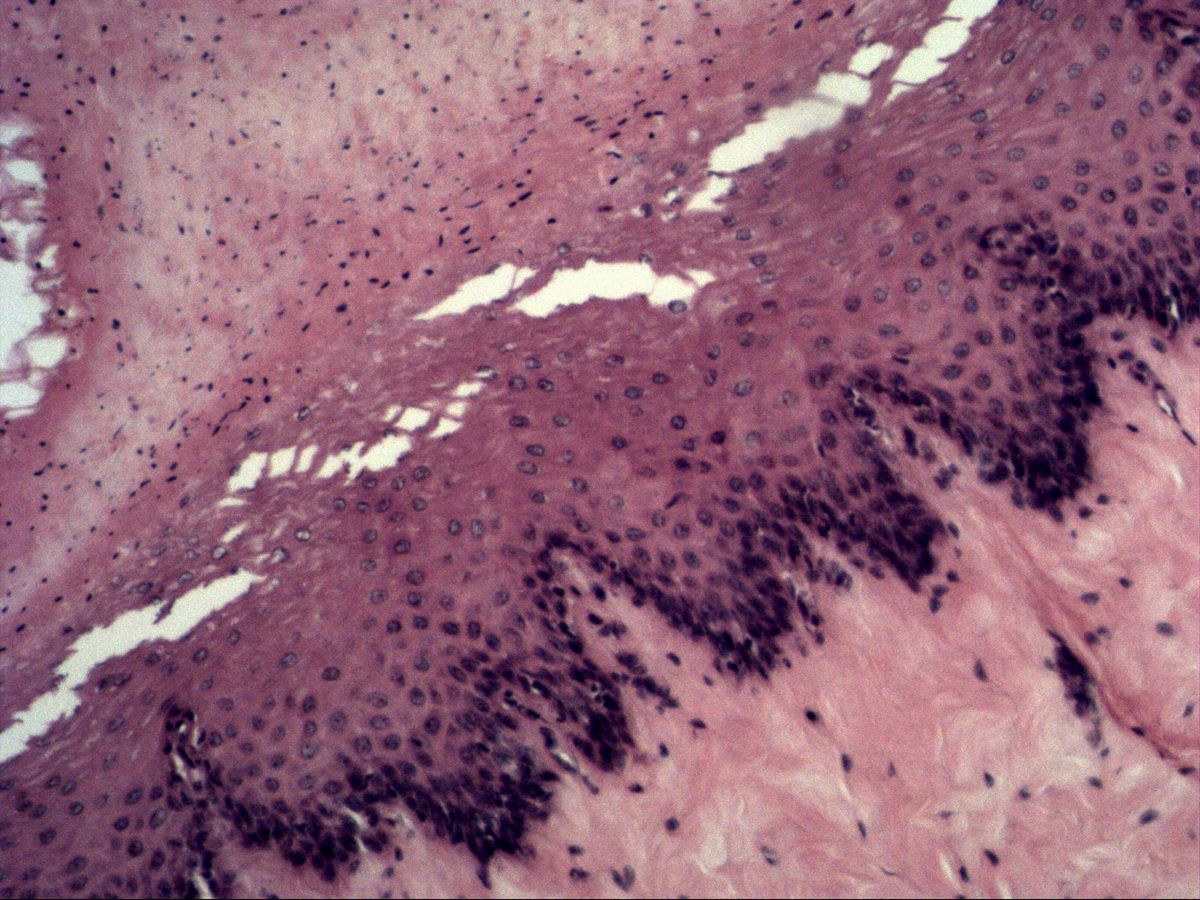 Oesophagus, H&E, medium magnification: layering of the squamous epithelium
