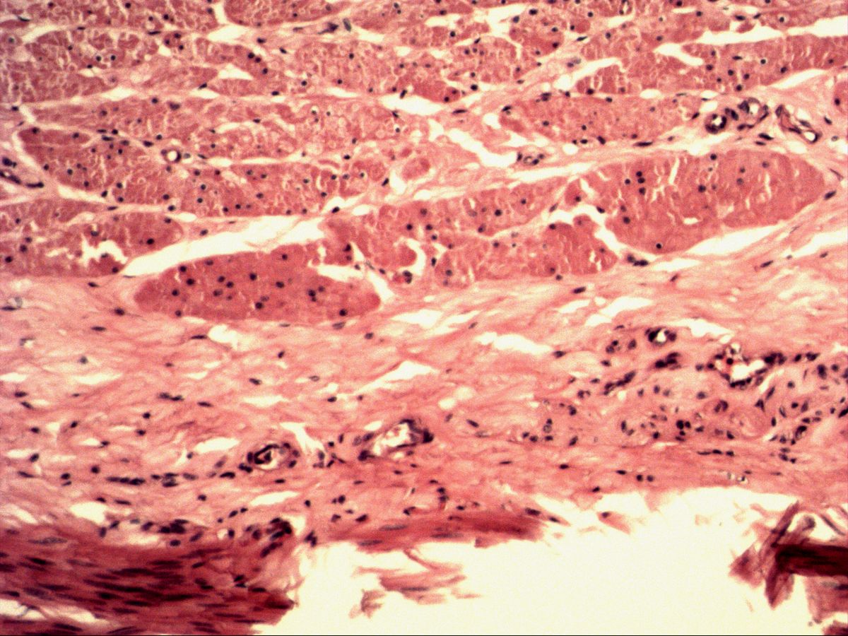 Oesophagus, H&E, medium magnification: muscular layer