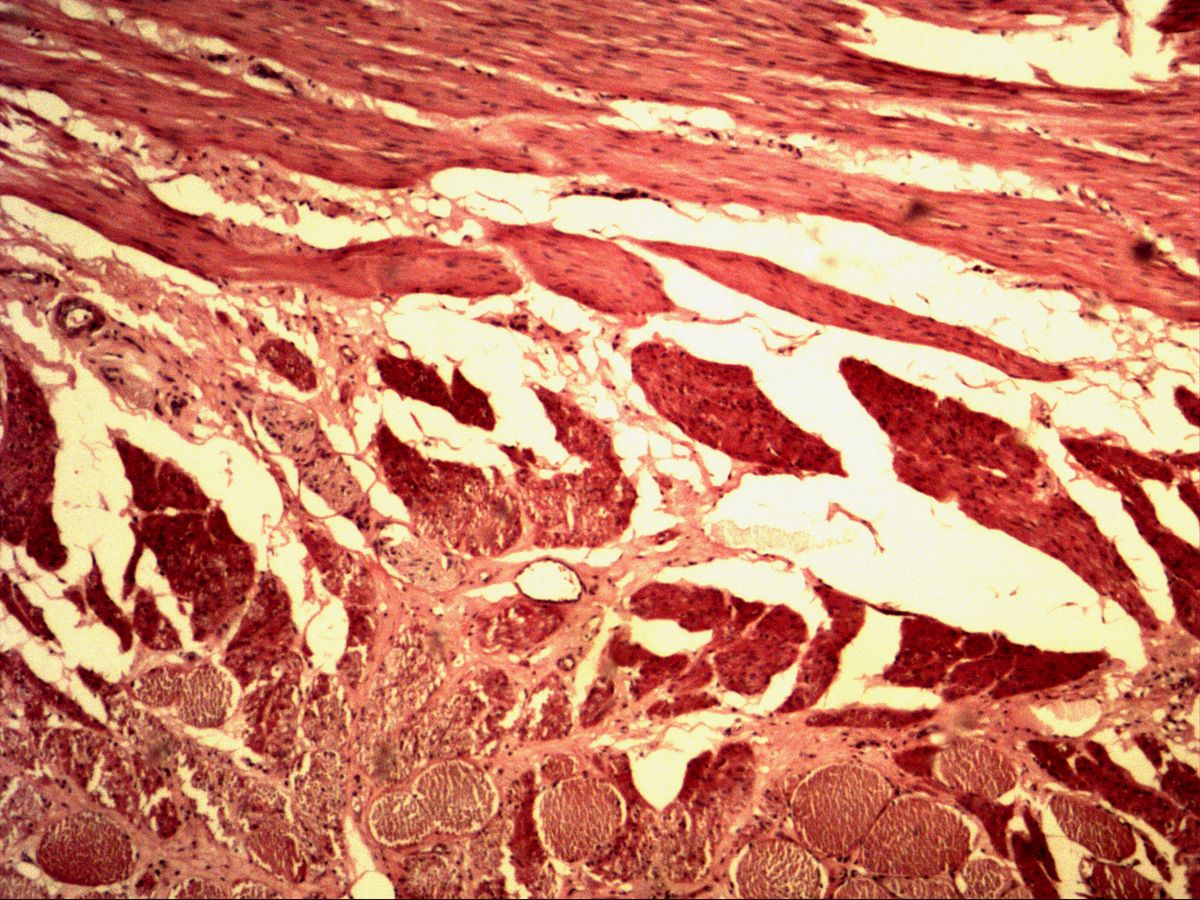 Oesophagus, H&E, overview: longitudinally and transversely cut muscle bundles