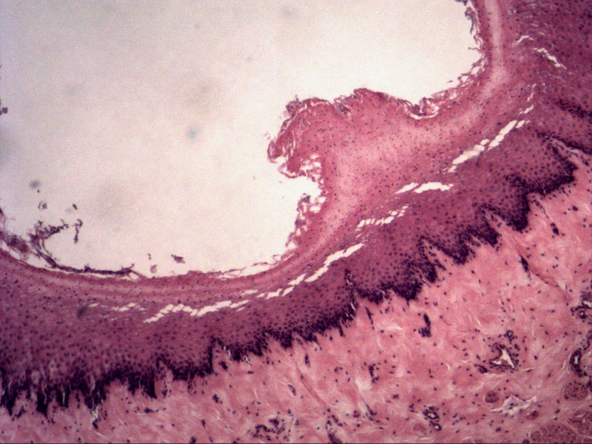 Oesophagus, H&E, overview: lumen, stratified squamous epithelium and lamina propria