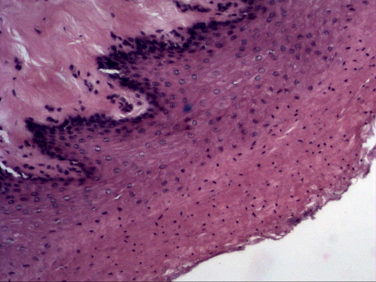 Non-keratinised stratified squamous epithelium, H&E, medium magnification, with basal layer, papillae and flat surface cells