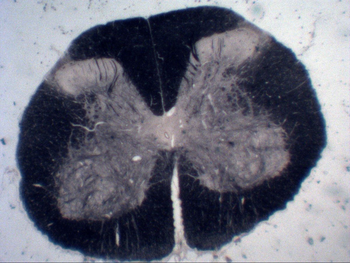 Spinal cord cross-section, myelin stain, overview: grey and white matter, ventral and dorsal horns