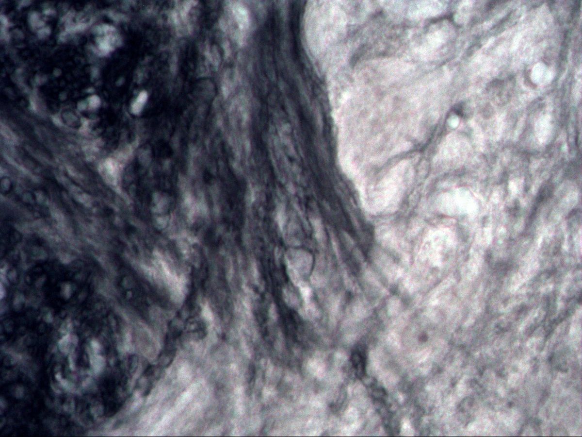 Spinal cord, myelin stain, border between white and grey matter