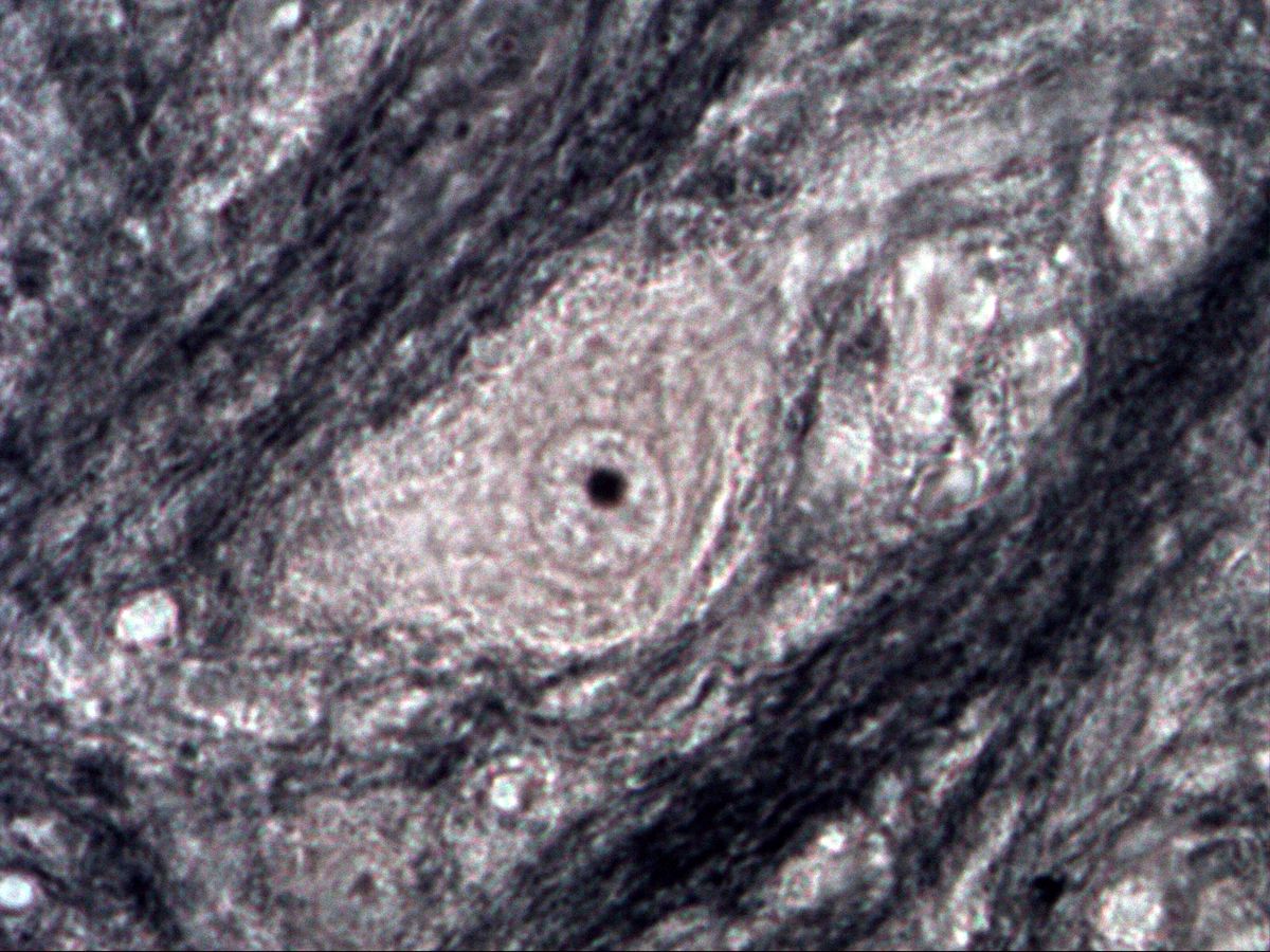 Spinal cord, myelin stain, high magnification, pale perikaryon with nucleolus