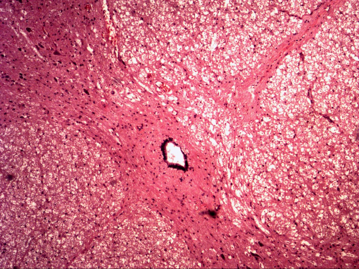 Spinal cord, H&E, medium magnification, central canal with ependyma, grey and white matter