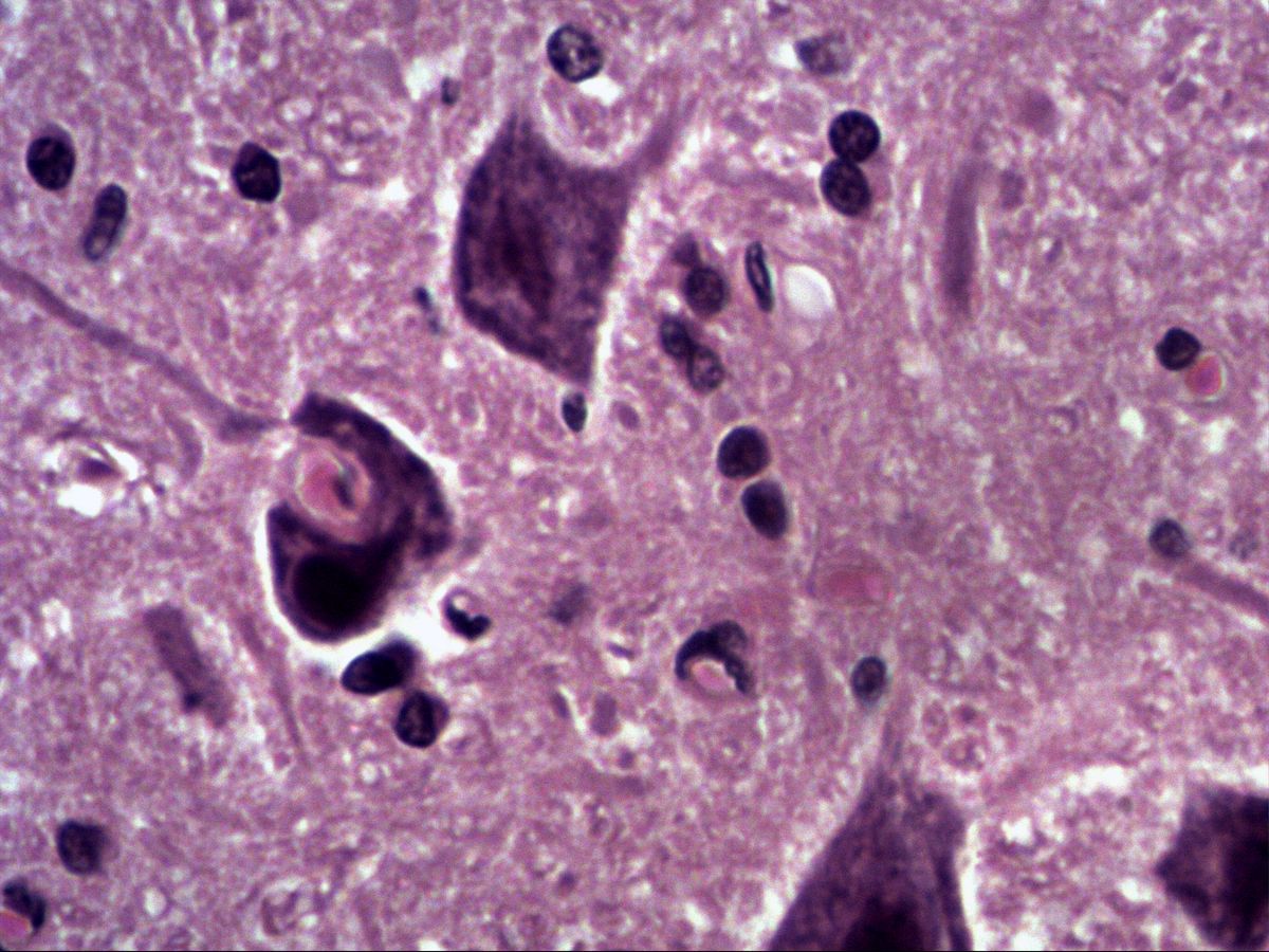 Ventral horn, H&E, high magnification, motor neurons and glial nuclei