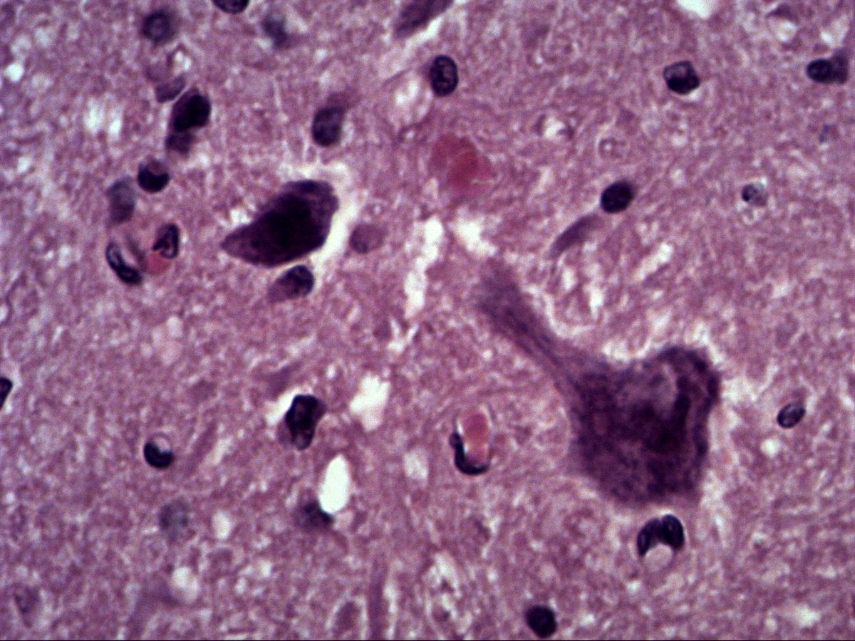 Multipolar motor neuron, H&E, high magnification, perikaryon with dendrite