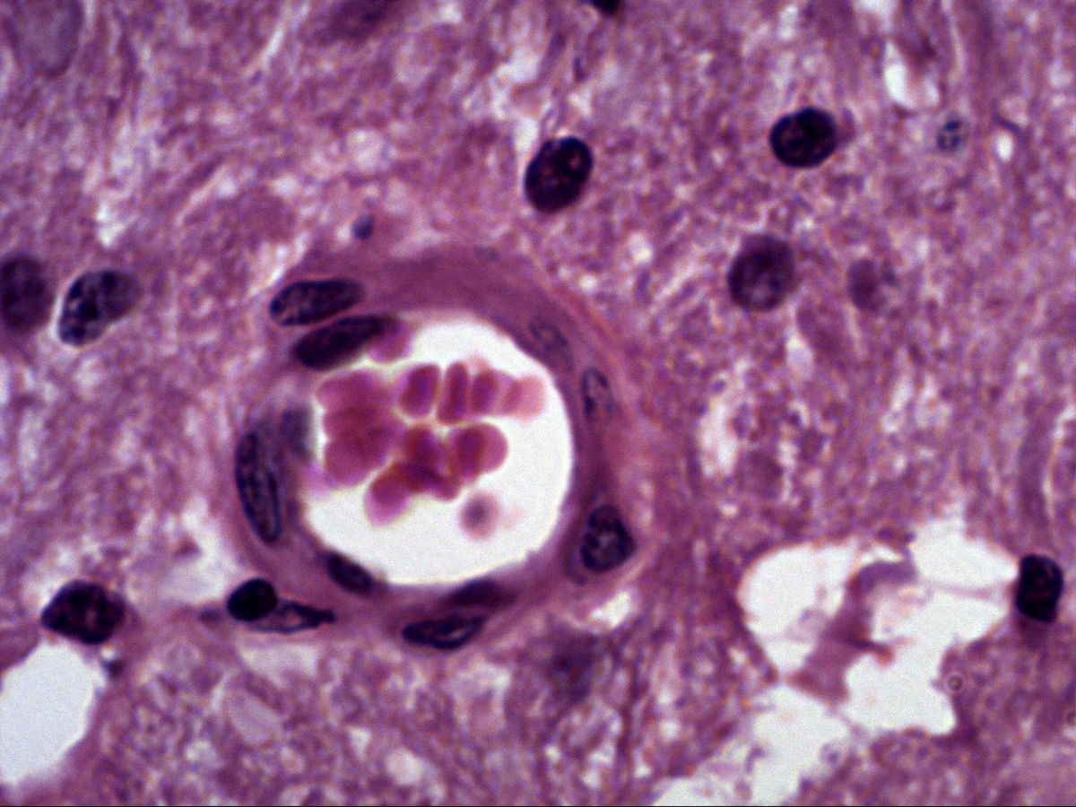 Spinal cord, H&E, high magnification, capillary with erythrocytes in the neuropil