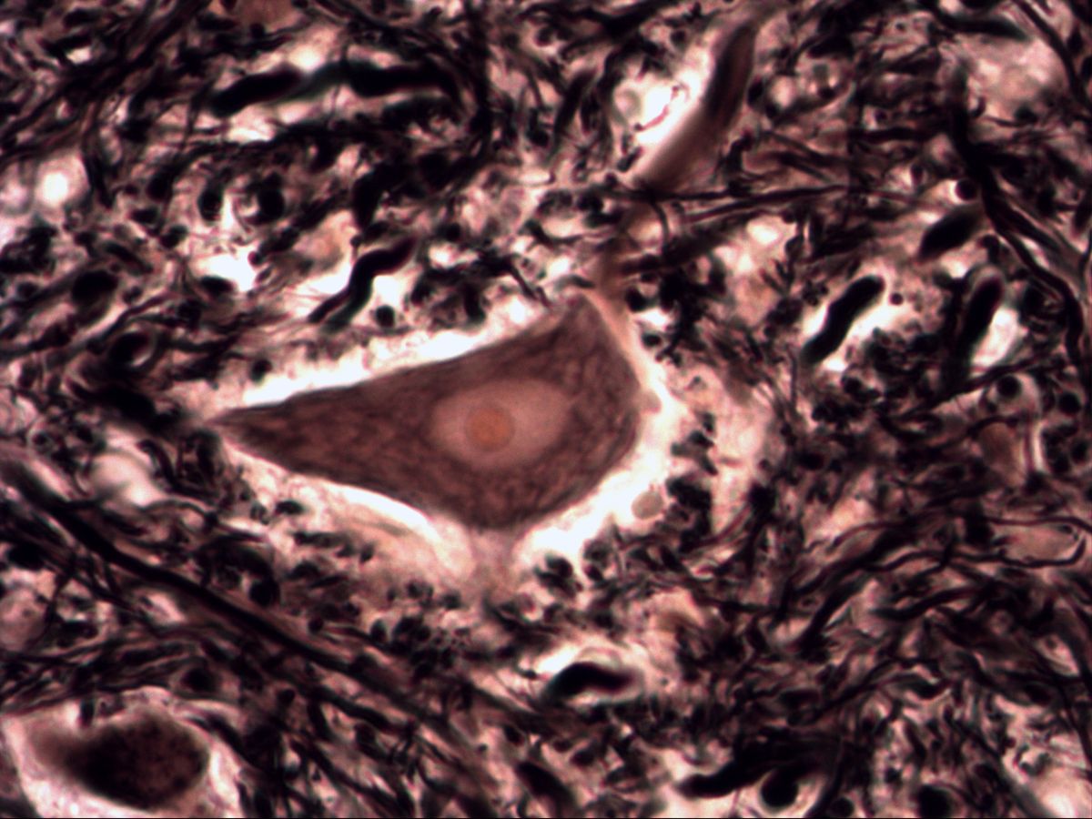Multipolar neuron, silver impregnation, high magnification, perikaryon in the neuropil