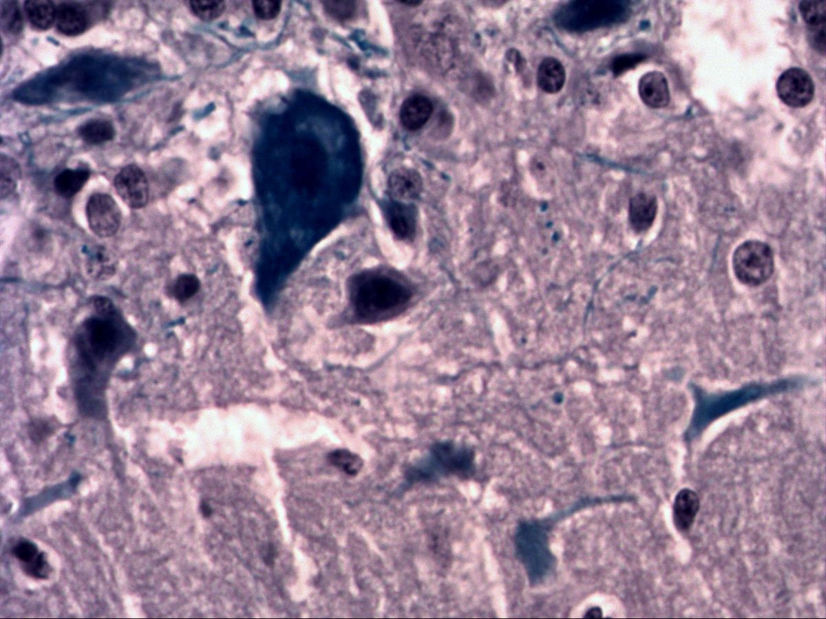 Multipolar neurons, Nissl-type stain, high magnification, blue perikarya