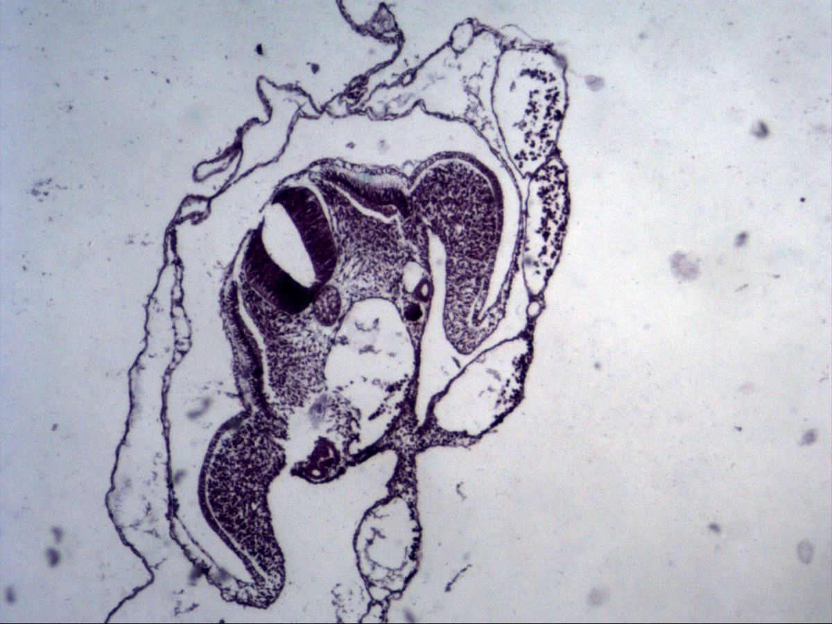 Chick embryo, H&E, overview: neural tube, notochord, mesoderm and extraembryonic membranes