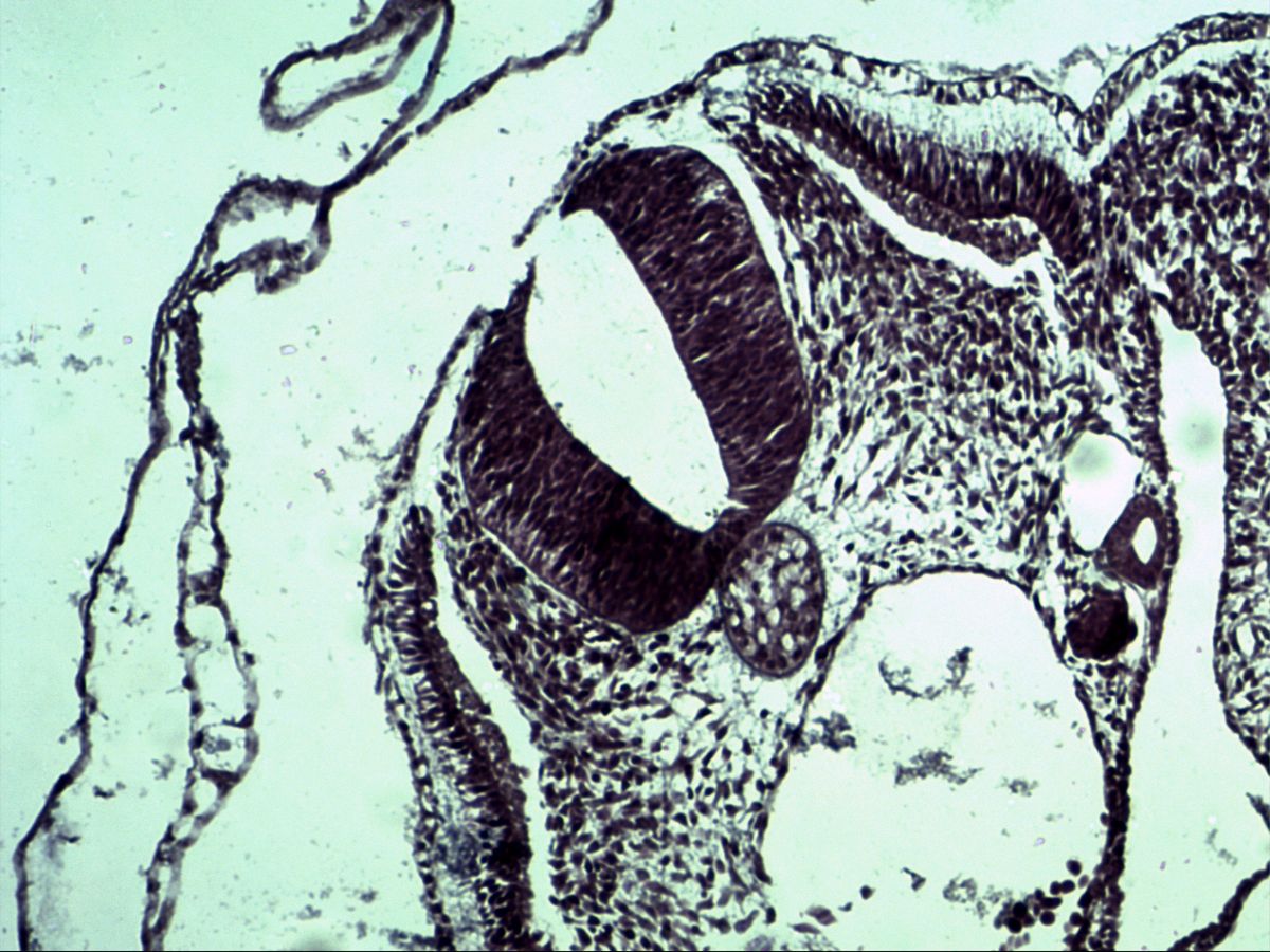 Chick embryo, H&E: neural tube, notochord and paraxial mesoderm