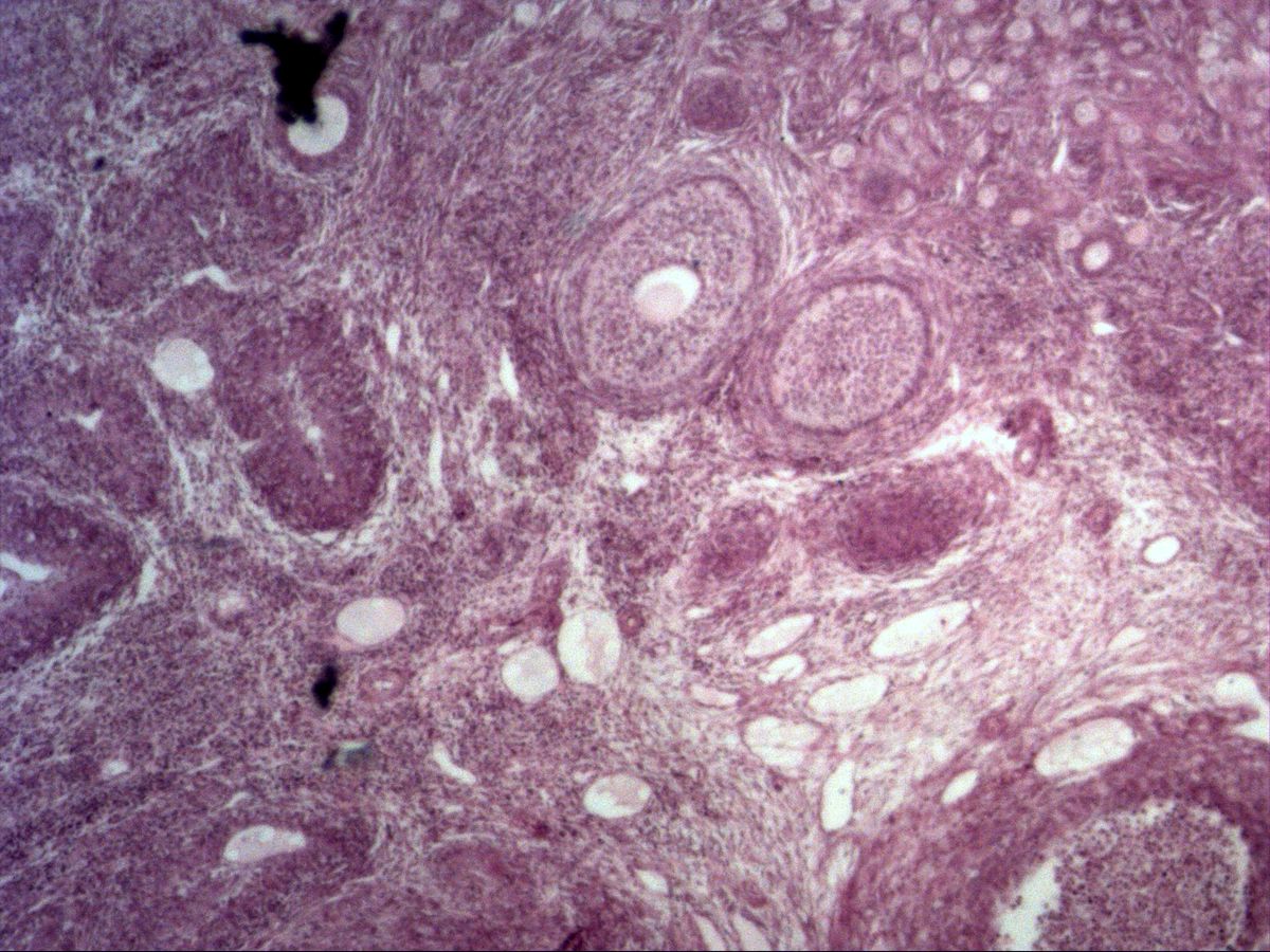 Ovary, H&E, overview: primordial, primary and secondary follicles in the cortical stroma