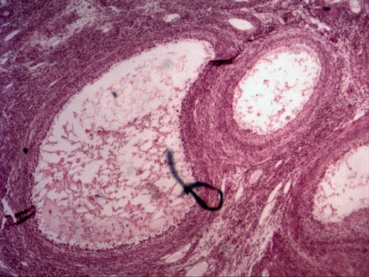 Ovary, H&E: tertiary follicles with antrum, stratum granulosum and theca