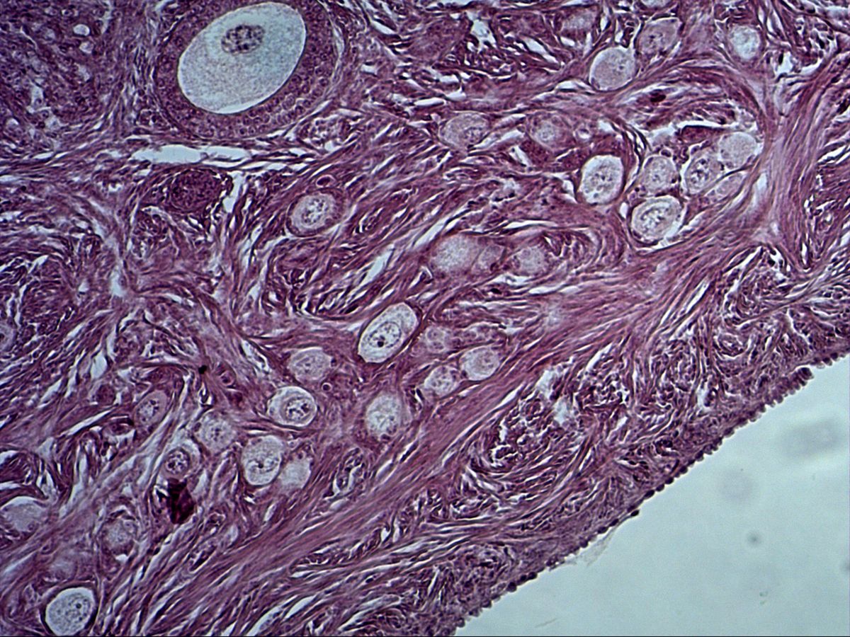 Ovarian cortex, H&E, high magnification: primordial follicles, primary follicle, surface epithelium