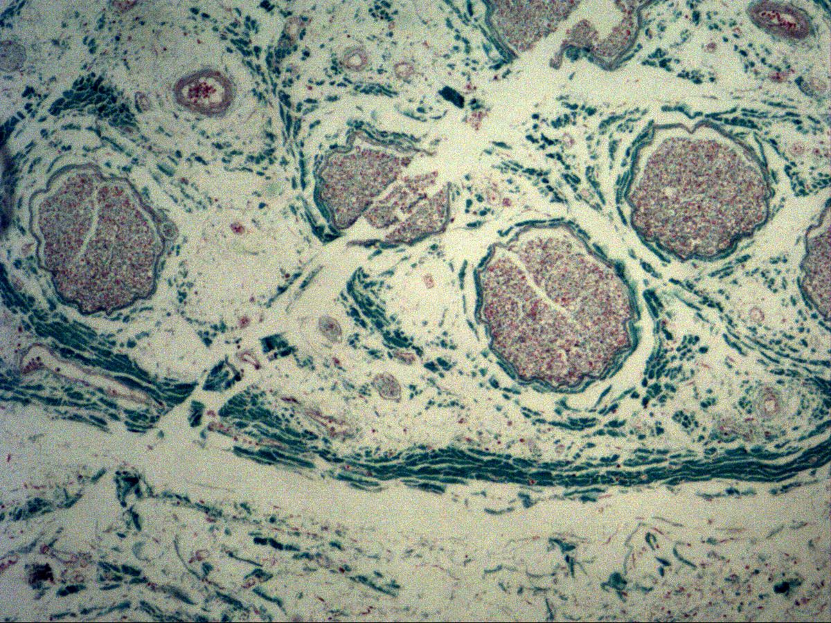 Peripheral nerve, cross-section, trichrome, overview: fascicles with perineurium in epineurium