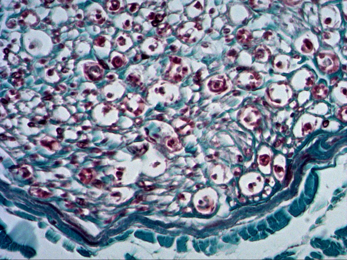 Nerve fascicle, cross-section, trichrome: axons, myelin sheaths, endoneurium and perineurium