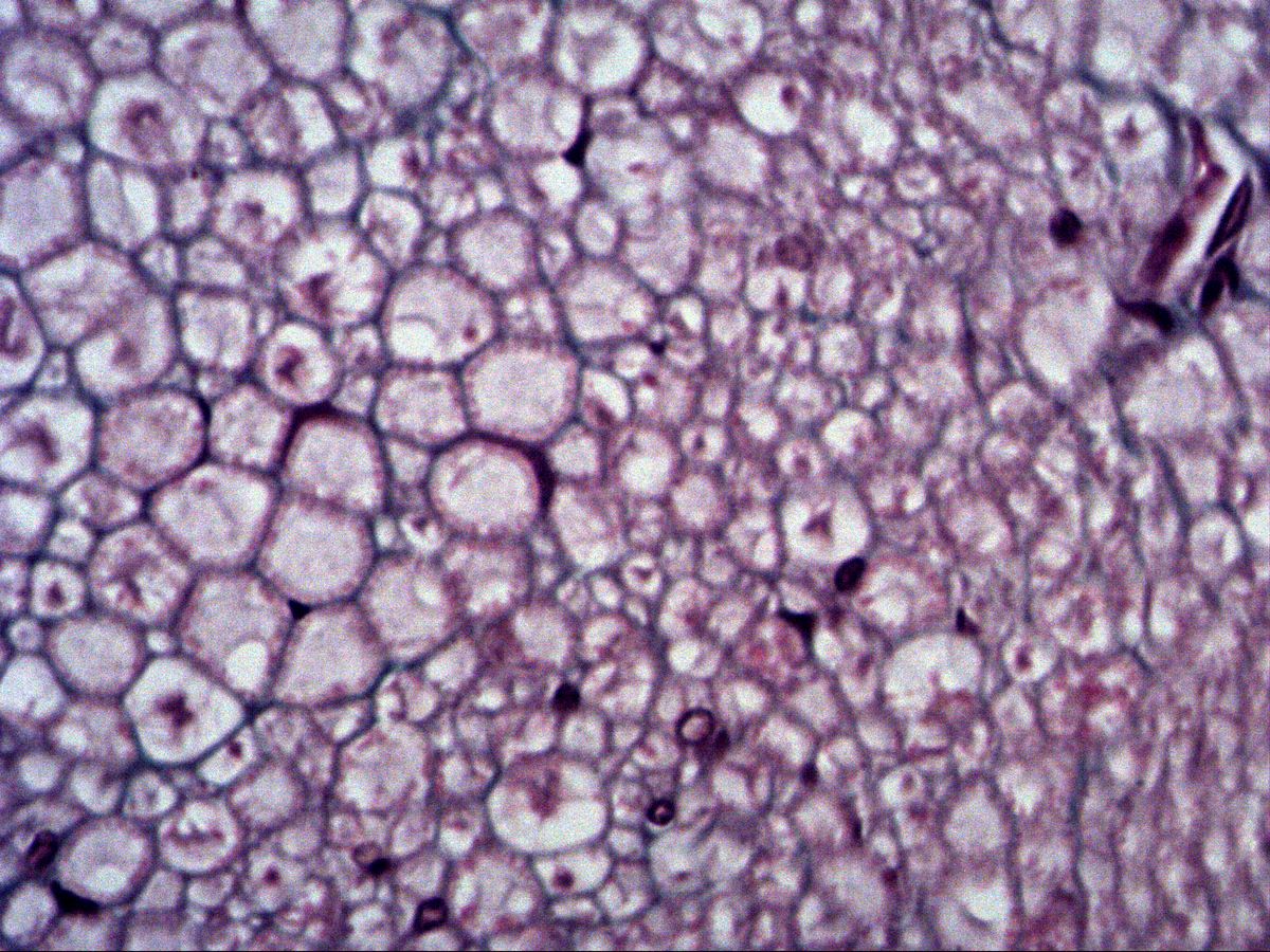 Thick and thin myelinated nerve fibres in cross-section, high magnification