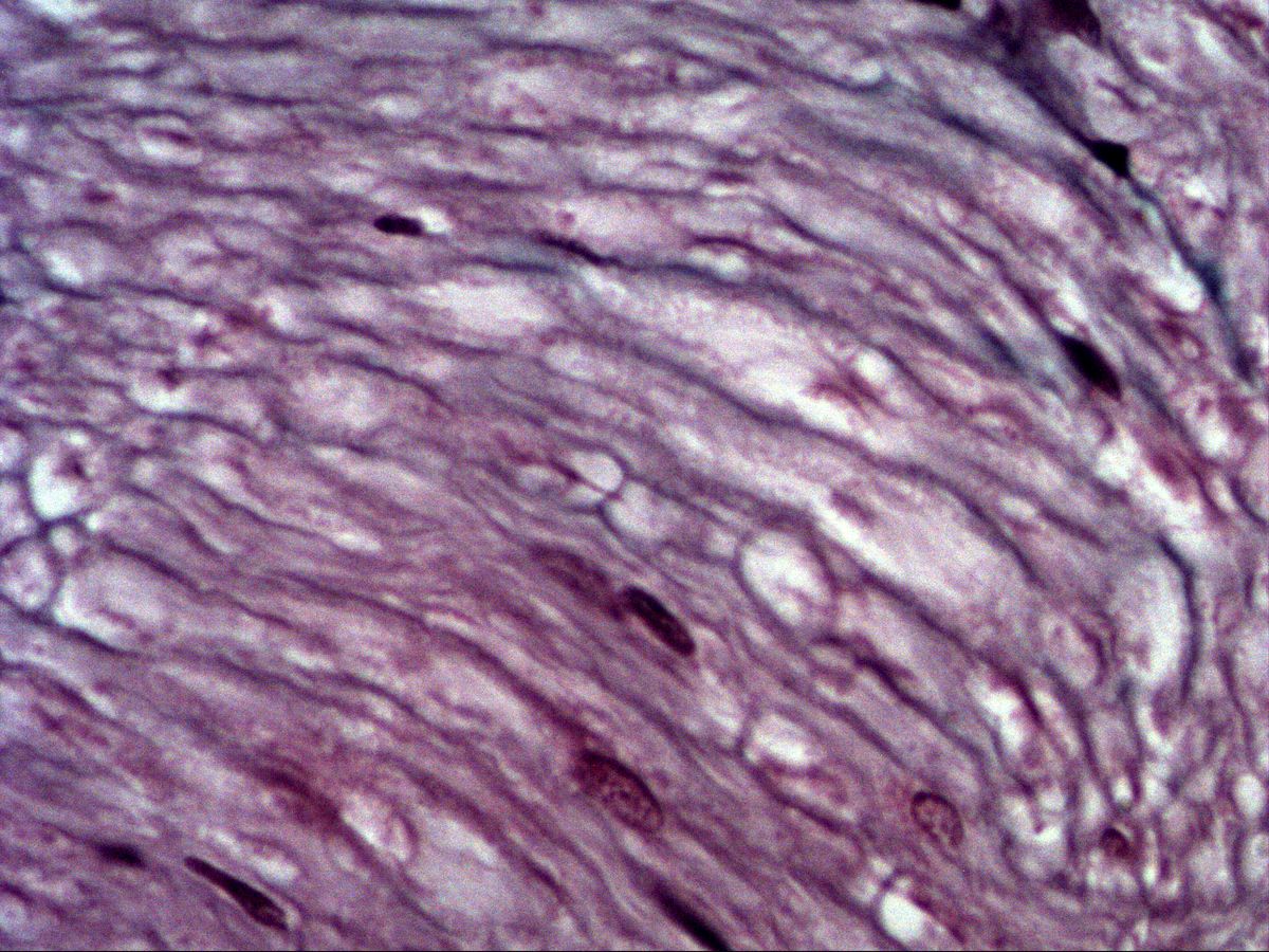 Peripheral nerve, longitudinal section, wavy fibres with elongated nuclei, high magnification