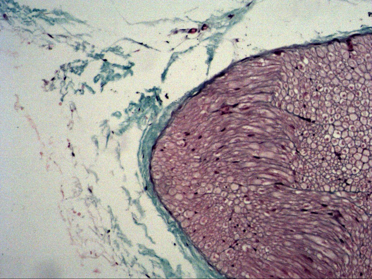 Nerve fascicle with perineurium and epineurium, trichrome, medium magnification