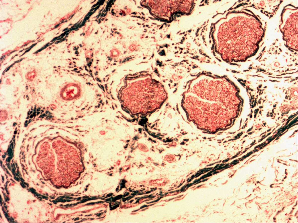 Femoral nerve, cross-section, overview: fascicles, perineurium, epineurium and arteriole
