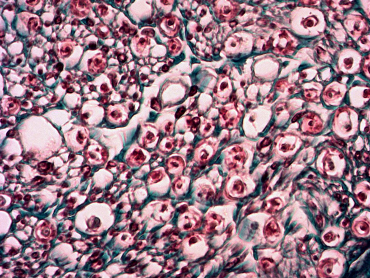 Myelinated nerve fibres in cross-section, trichrome, high magnification: axons, myelin, endoneurium