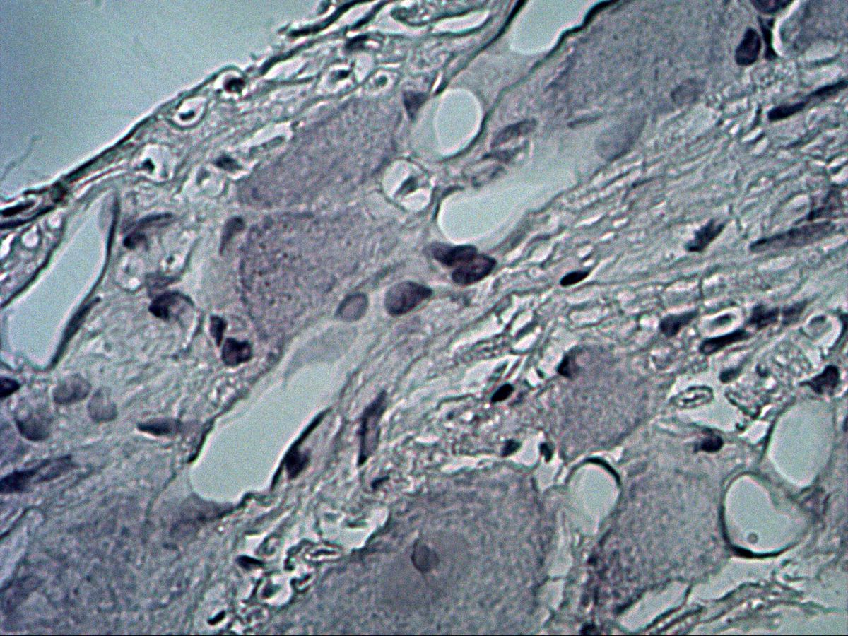 Trigeminal ganglion, H&E, margin with capsule and neurons