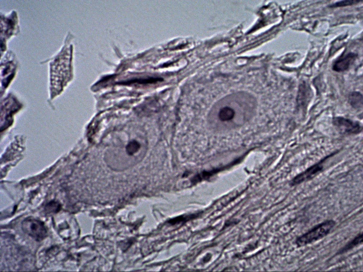 Pseudounipolar neurons, H&E, high magnification, nucleus with nucleolus and satellite cells