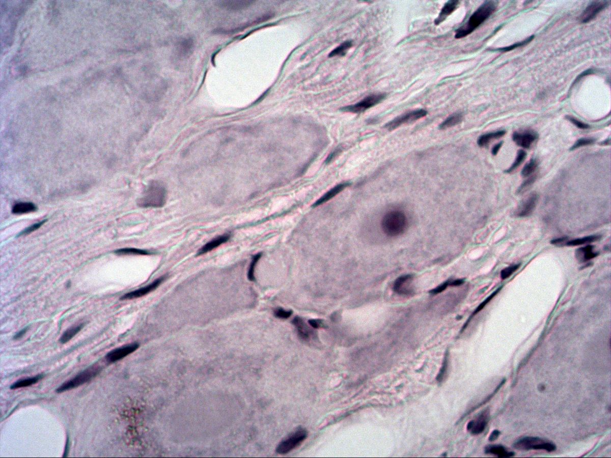 Pseudounipolar neuron, H&E, high magnification, nucleolus and satellite cells