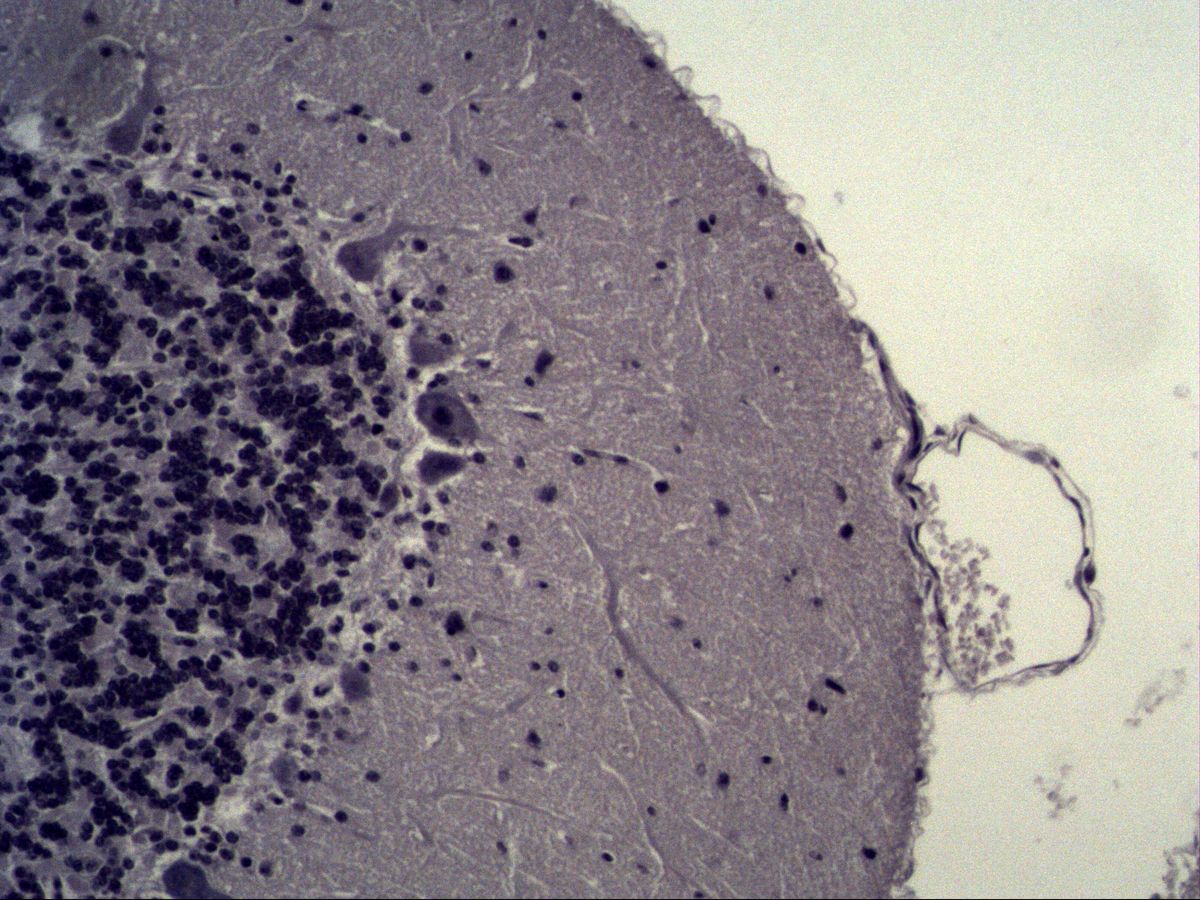 Cerebellar cortex, Fast Blue, medium magnification: granular layer, Purkinje cells, molecular layer, pia