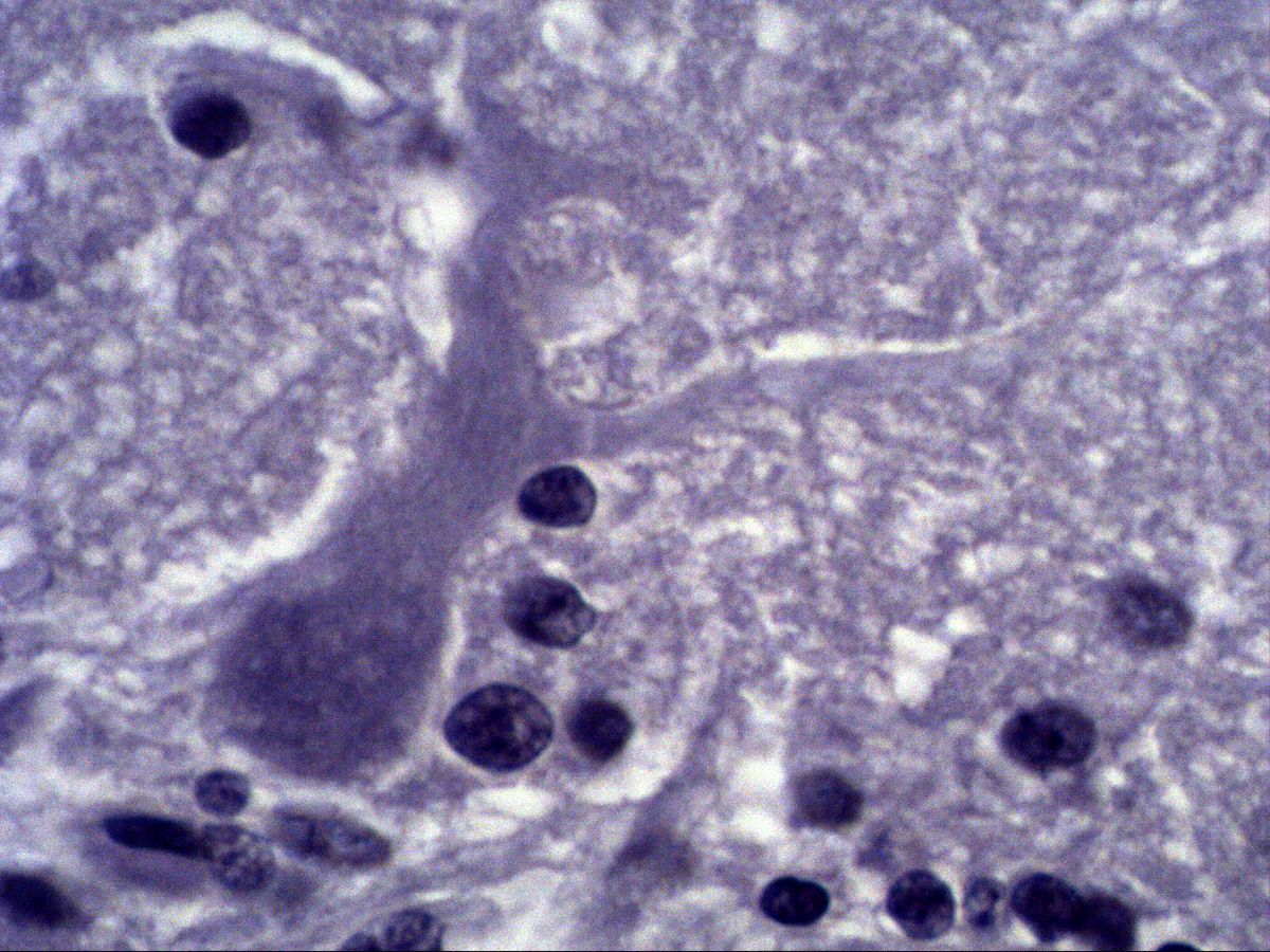 Purkinje cell with dendritic trunk, Fast Blue, high magnification