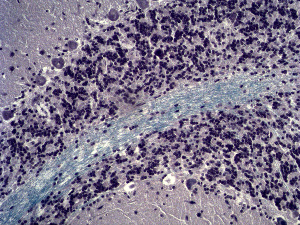 Cerebellar granular layer with blue white matter, Fast Blue, medium magnification