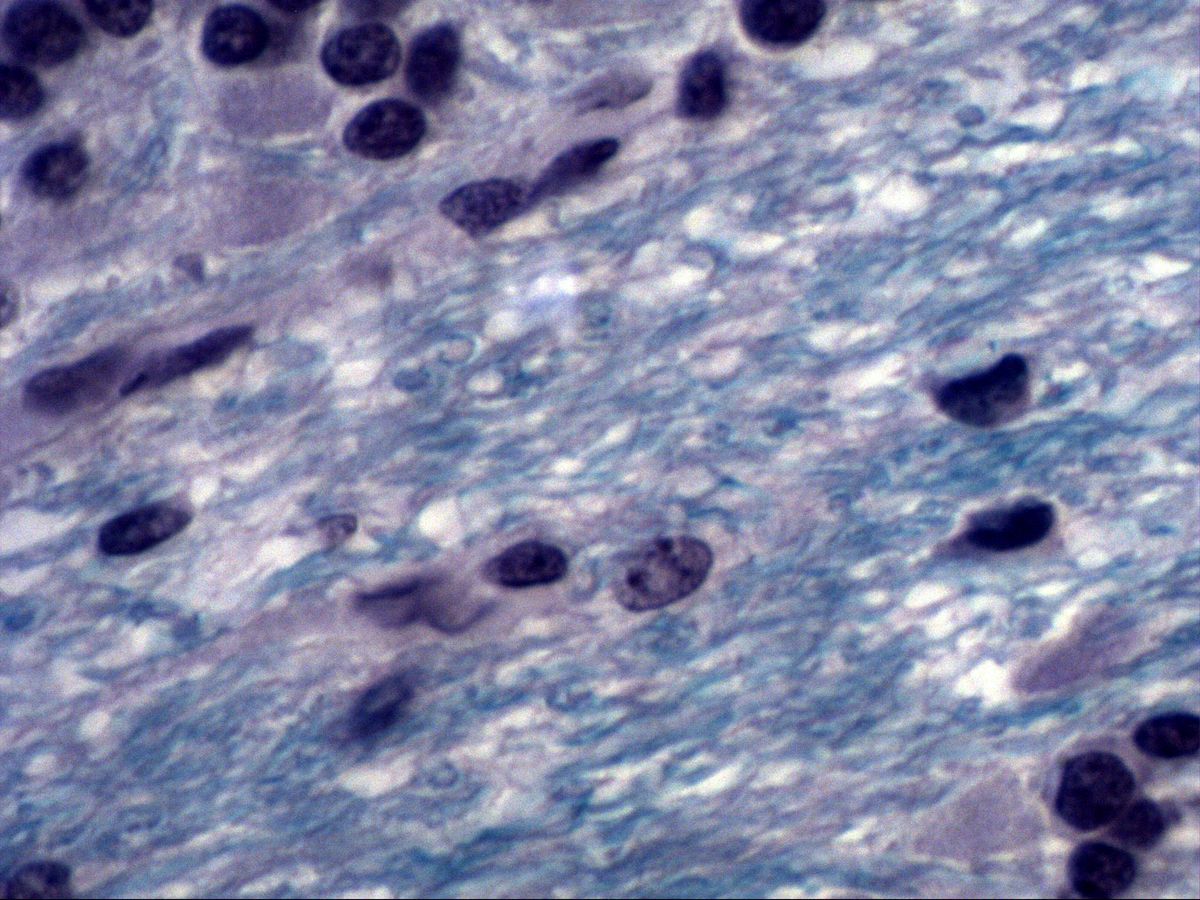 Cerebellar white matter with blue myelin and glial nuclei, Fast Blue, high magnification